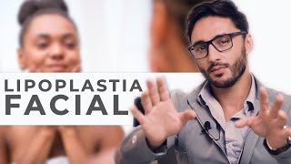 LIPOPLASTIA FACIAL  Dr Thales Cousen [upl. by Huberman]