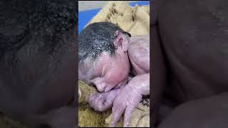 Vernix caseosaknown as vernix is the waxy white substance found coating the skin newborn human baby [upl. by Barncard214]