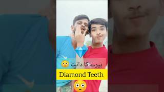 How to clean diamond teeth  Teeth  ytshorts shorts shortsfeed diamonds teethcleaning teeth [upl. by Ahsieyk]