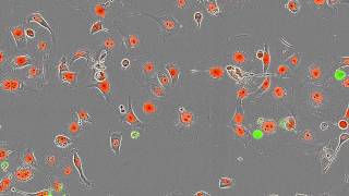 Essen BioScience CellPlayer Kinetic Cytotoxicity Assay [upl. by Admama962]