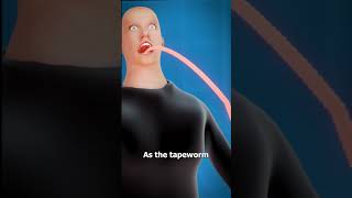 What Is A Tapeworm 😨 [upl. by Nosaes]