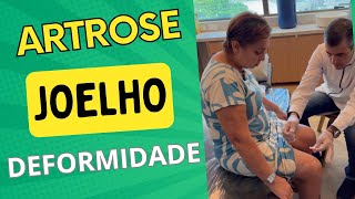 DEFORMIDADE NO JOELHO  ARTROSE HÁ MAIS DE 26 ANOS  artrose joelho fisioterapia acupuntura [upl. by Larentia]