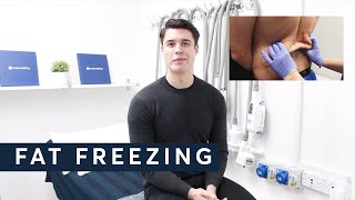 Fat Freezing For Men  Coolsculpting Experience [upl. by Nea673]