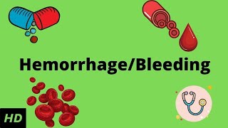 Hemorrhage bleeding Causes Signs and Symptoms Diagnosis and Treatment [upl. by Chesnut]