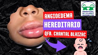 ANGIOEDEMA HEREDITARIO [upl. by Allerbag]