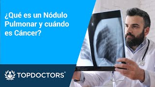 ¿Qué es un Nódulo Pulmonar y cuándo es Cáncer [upl. by Erihppas167]