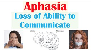 Aphasia  Types Broca’s Wernicke’s Global Causes Signs amp Symptoms Diagnosis Treatment [upl. by Littman]