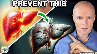 1 Absolute First Sign That Your Liver is Dying [upl. by Oine]