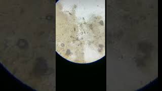 bacterial infection in animals saliva  dog bite  rabies dogs infection [upl. by Kcirdderf]