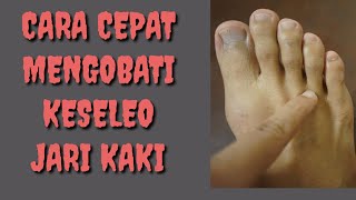 CARA CEPAT MENGOBATI KESELEO JARI KAKI MUDAH SIMPLE DAN MANJUR [upl. by Hcardahs]