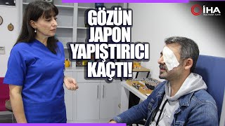 Sol Gözüne Kaçan Japon Yapıştırıcısı Hastanelik Etti [upl. by Carmine]