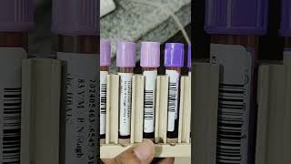 HbA1C Test Hematology Lab resultD 10 [upl. by Rosabella]