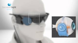 Second Sight Argus II Retinal Prosthesis System English [upl. by Charteris600]