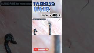 Plucking Hair With 300x Zoom Wet limp root with keratine and dead skin cells [upl. by Martel]