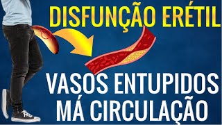 DISFUNÇÃO ERÉTIL  veias do pênis entupidas [upl. by Enobe311]