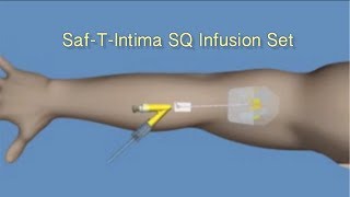 How to Insert SafTIntima™ SQ Infusion Set [upl. by Doak300]