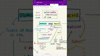 Otogenic Brain Abscess made easy [upl. by Larrej320]