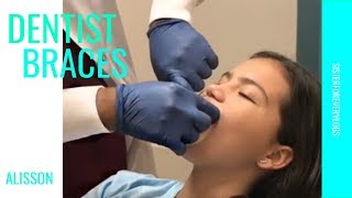 ORTHODONTIST BRACES APPOINTMENT 349 [upl. by Yevrah]