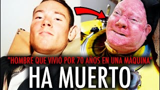 MUERE EL HOMBRE que vivió 70 años en UN PULMÓN DE ACERO [upl. by Shieh]