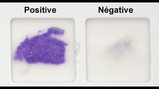 Oxidase Test Practical Tutorial [upl. by Bristow327]