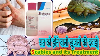 scabies treatment scabies rash how to get rid of scabies  scaboma lotion [upl. by Elesig]