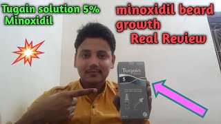 Cipla Tugain 5 solution minoxidil genuine review beard [upl. by Idyak]