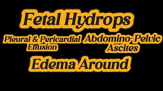 Fetal Hydrops  Ascites  Swelling  Pleural amp Pericardial Effusion  IUD 25 weeks on Ultrasound [upl. by Ayam]