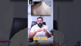 നിങ്ങൾക്ക് Body Acne ഉണ്ടോ  Do you have body acne  Brighten Up [upl. by Billmyre264]