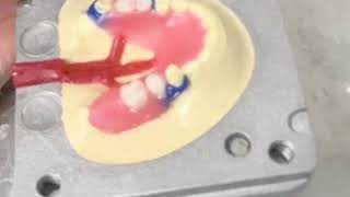 DuraFlex Partials Start to Finish in Only 3 Minutes [upl. by Imugem]