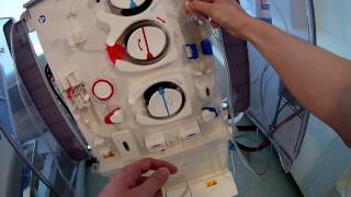 How to setup dialysis fresenius 5008 machine Frenchdialyse [upl. by Kceb]