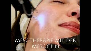 Mesotherapie mit der Mesogun im Urban Spa Hamburg [upl. by Nesilla]