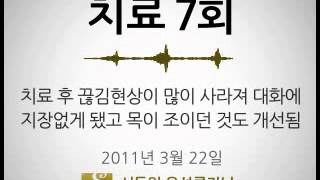 연축성 발성장애 여 30대 회사원 [upl. by Eetnom]