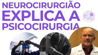 Tudo sobre Psicocirurgia com Neurocirurgião [upl. by Emilia]