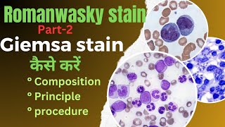 Giemsa stain procedureromanwasky stain in hematologyBlood film preprationamp identification of cells [upl. by Arodal984]