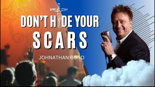 “Don’t Hide Your Scars” Johnathan Bond Atlanta Live [upl. by Anawd512]