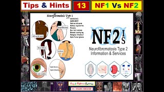 NF1 Vs NF2 Tips amp Hints 13 [upl. by Callida815]