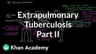 Extrapulmonary TB Part 2  Infectious diseases  NCLEXRN  Khan Academy [upl. by Phil]