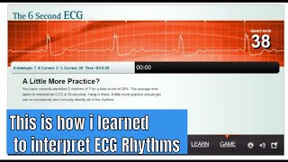 Learn to interpret ECG rhythm with the game [upl. by Odnomyar]