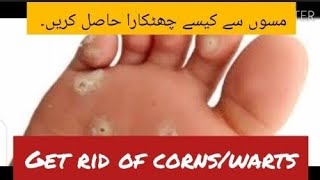 Getrid of CornWarts on foot by Dr Amara 2024Duofilm Lotion Uses in Urdu HindiDr Health [upl. by Nerwal807]