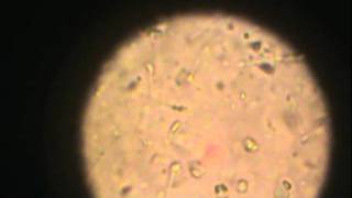 Observación de espermatozoides en microscopio óptico 1 [upl. by Iney256]