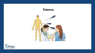 Tetanus [upl. by Acinoda]