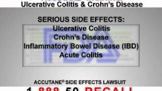 Accutane Has Been Linked with Causing Crohns Disease [upl. by Ecilayram29]