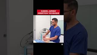 Guedel Airway Insertion Technique  anesthesia bagmaskventilation airway [upl. by Frazier99]