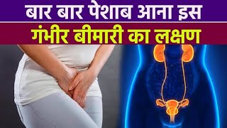 I Tried 10 Home Remedies for Frequent Urination and You Wont Believe What Happened [upl. by Ailongam]