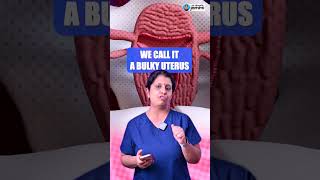 What You Need To Know About Adenomyosis  Dr Deepthi Jammi [upl. by Colman]