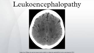 Leukoencephalopathy [upl. by Niatsirk]