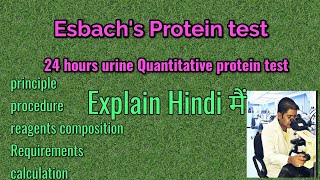 Esbachs Test for protein24 hours protein test Esbacha AlbuminometerUrine chemical Examination [upl. by Pardew]