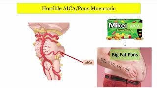 12DaysinMarch Stroke Localization Brainstem Part 3 of 3 for the USMLE Step One Exam [upl. by Fredela]