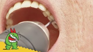 Ouvrier Devient Dentiste de Dernière Minute [upl. by Allista991]