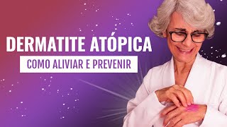 DERMATITE ATÃ“PICA EM CRIANÃ‡AS  INFLAMAÃ‡ÃƒO NA PELE  MACETES DE MÃƒE [upl. by Anilemrac]